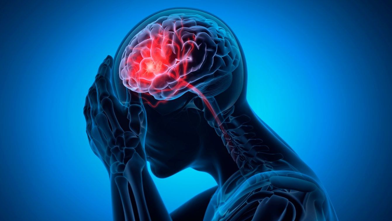 Stroke. Representative Image. (iStock)