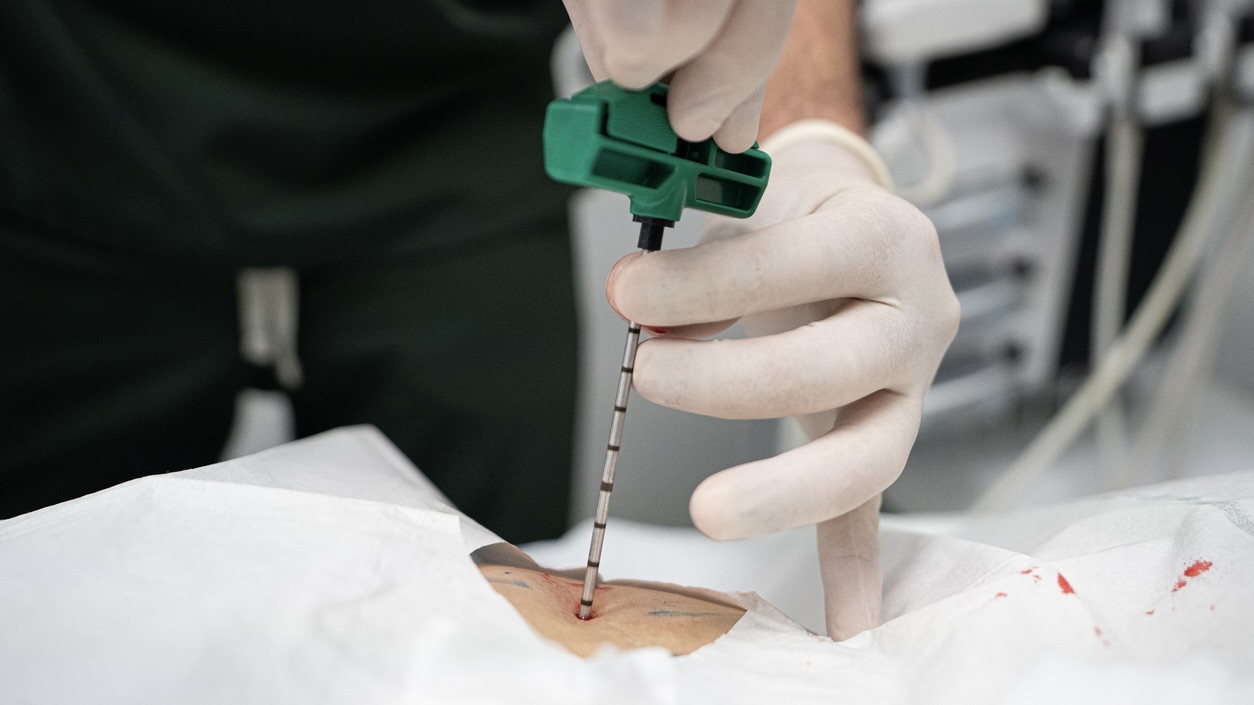 Bone marrow transplant: How half-match donors are expanding options for children in India