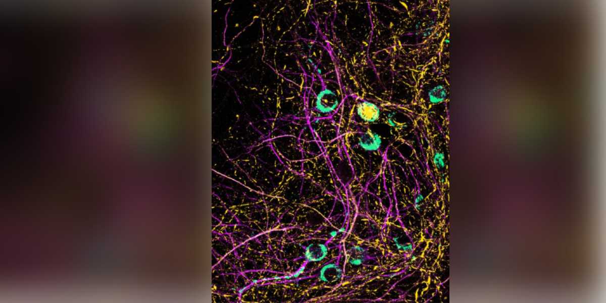 Body fights flu and COVID, but the price it pays may be a Parkinson’s risk