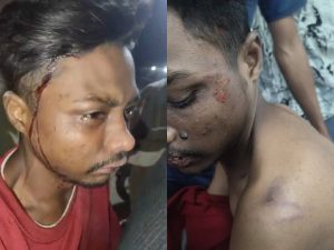 Images showing Fayaz's injuries