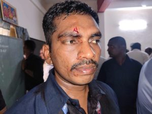 Midhun Reddy's gunman injured